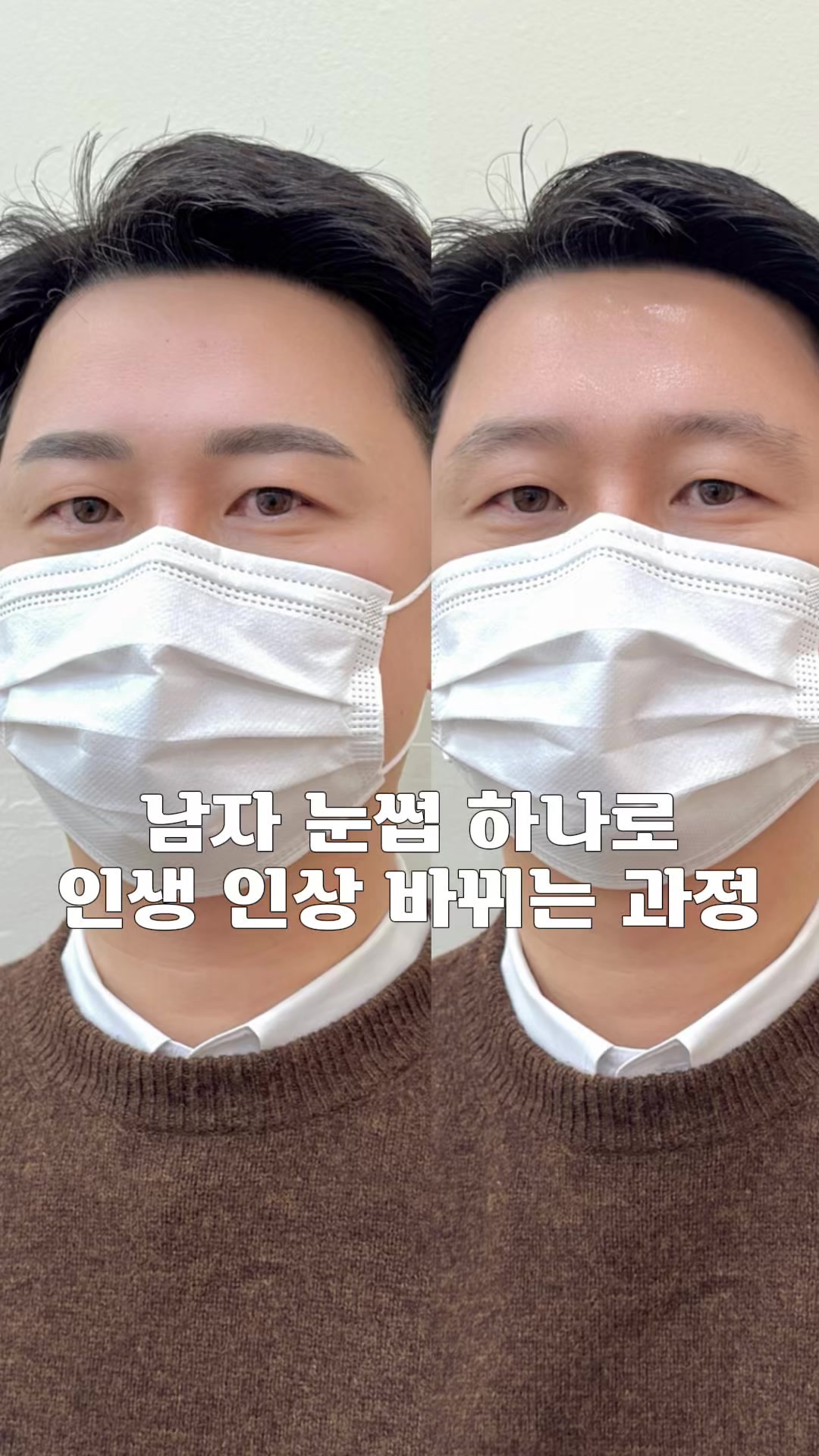 @강남눈썹문신|강남반영구 브로우뉴진