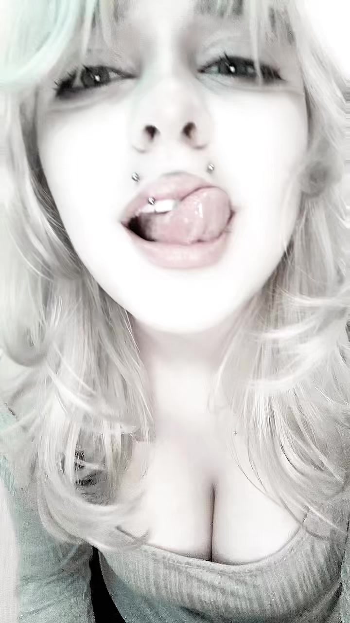 @uglyrosis