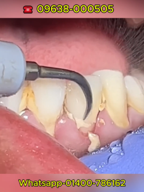 @Tech Dental