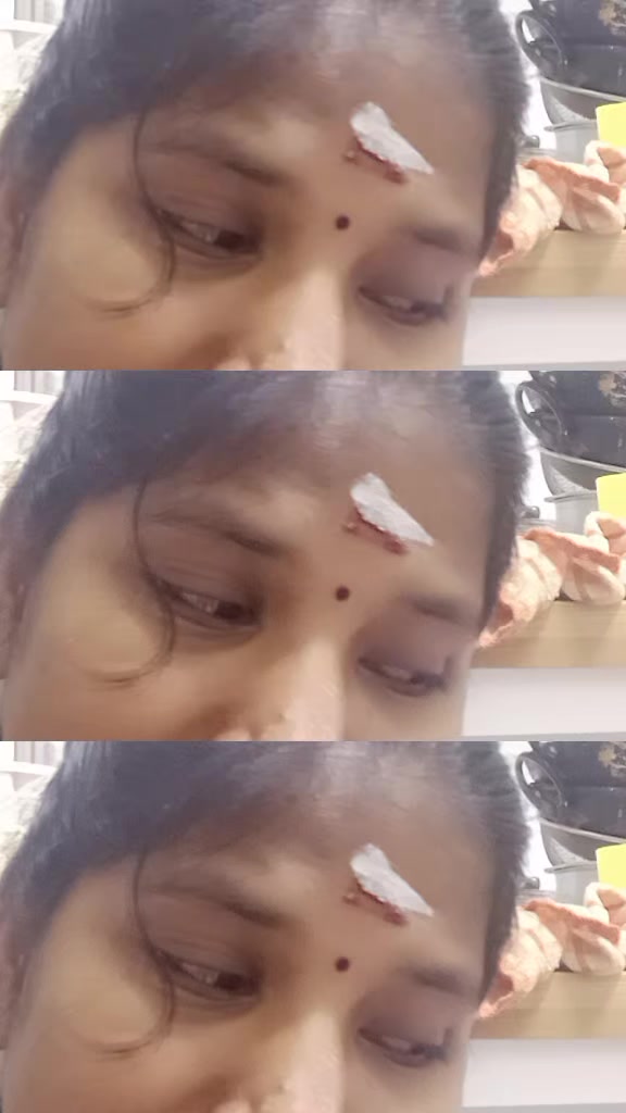 @revathi murali