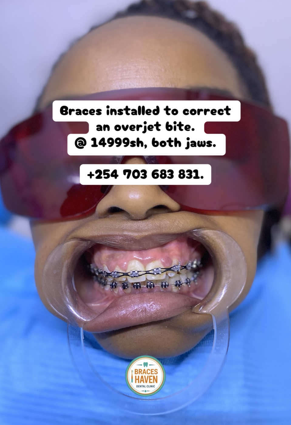 @Braces Haven Nairobi Dental