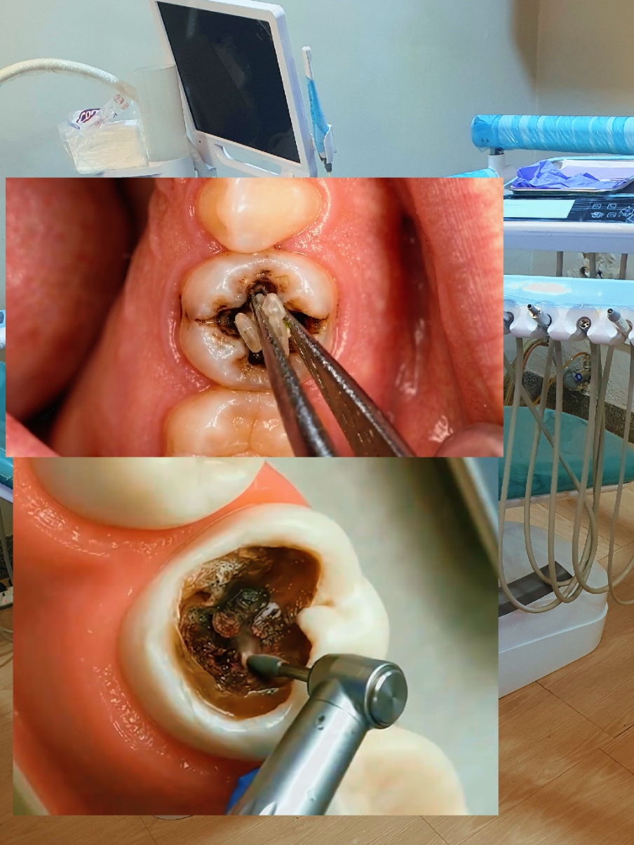 @@KAI Dentalcare123kampala
