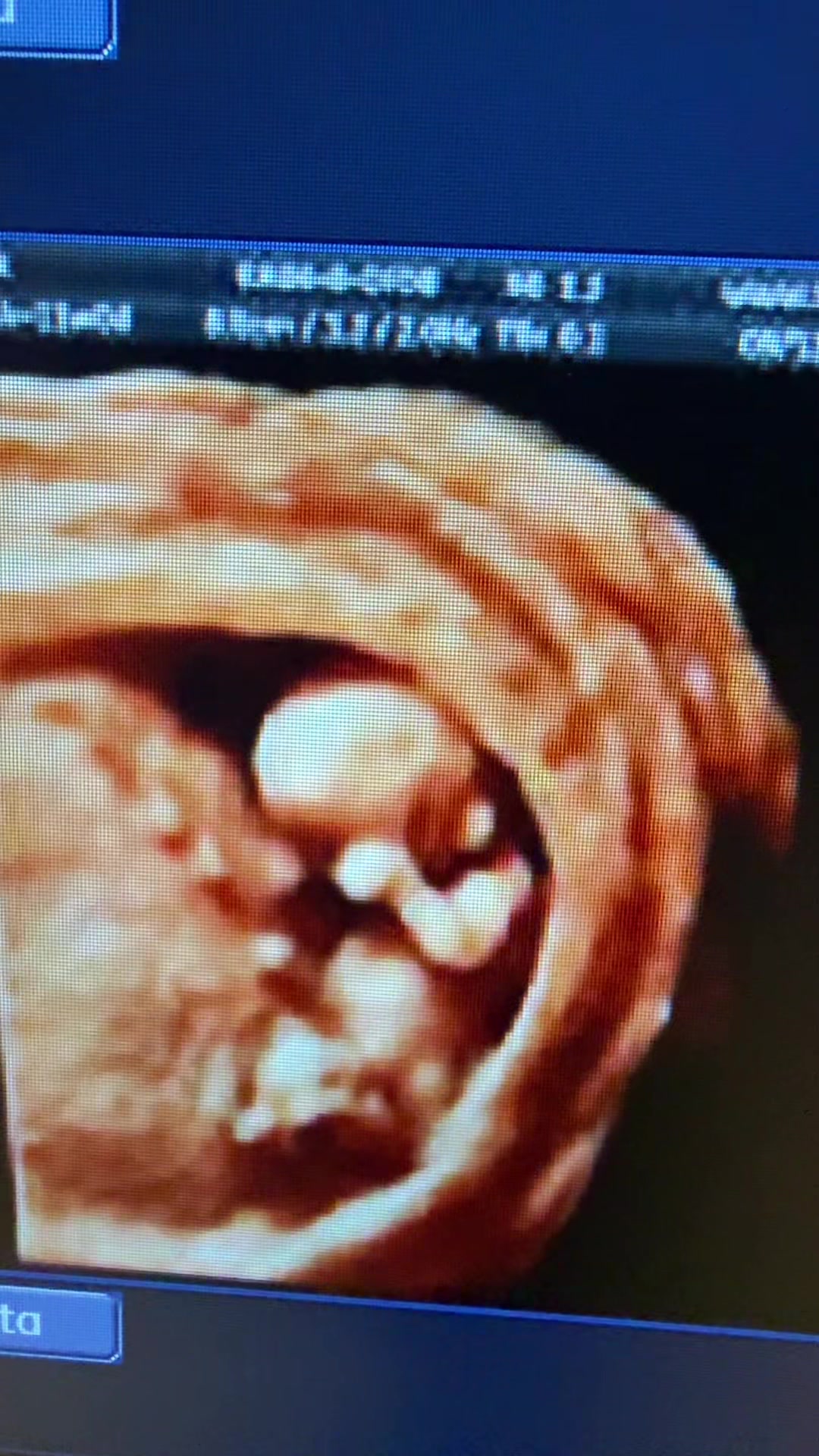 @PregnantSee Inc.