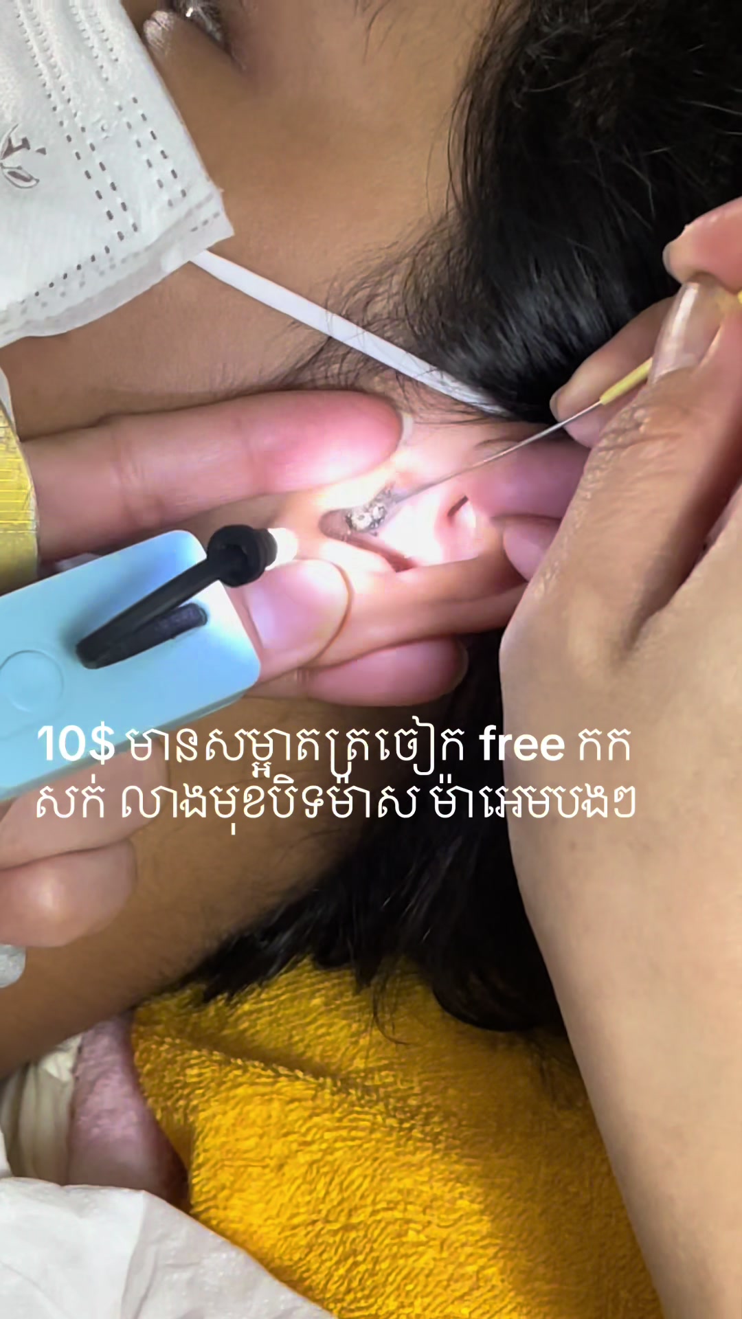 @ហាង សំអាតត្រចៀក 081 674455