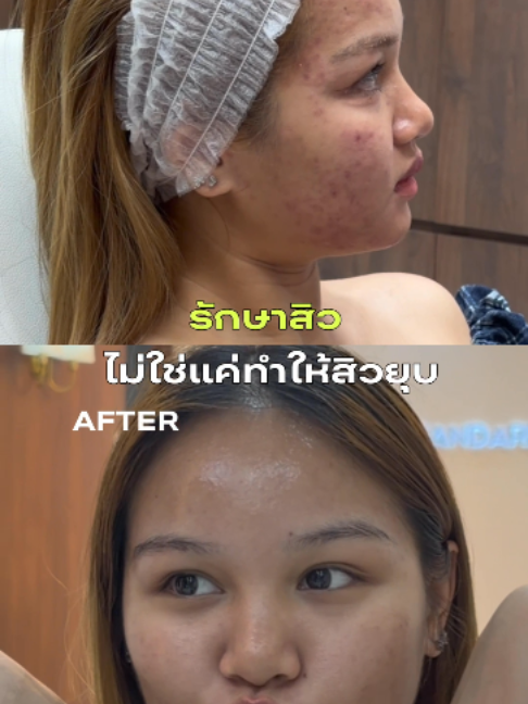 @Standard Skin clinic