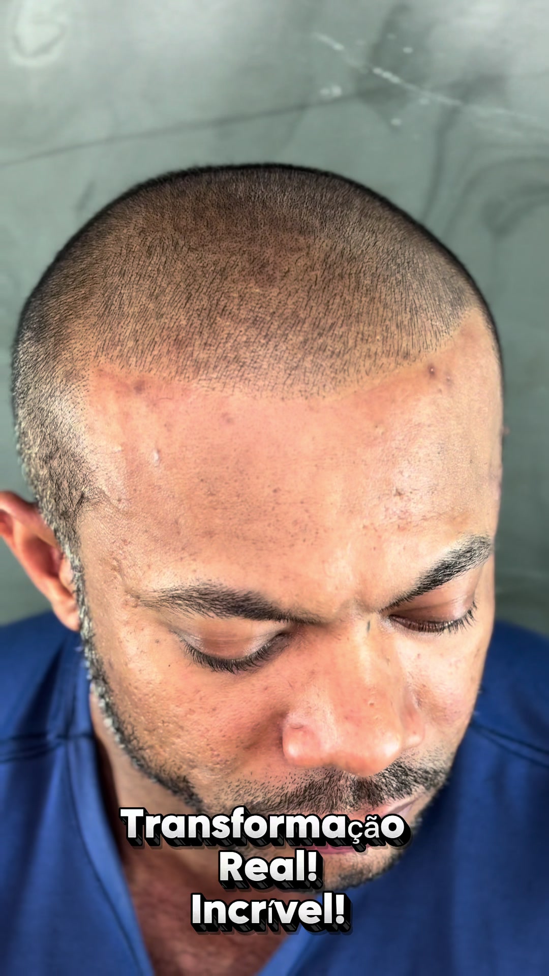 @Valesca Abi Ackel Scalp