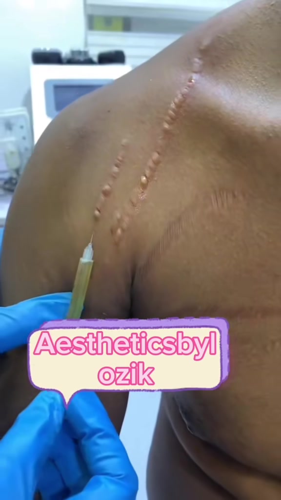 @LOZIK AESTHETICS | SPA IN AJAH