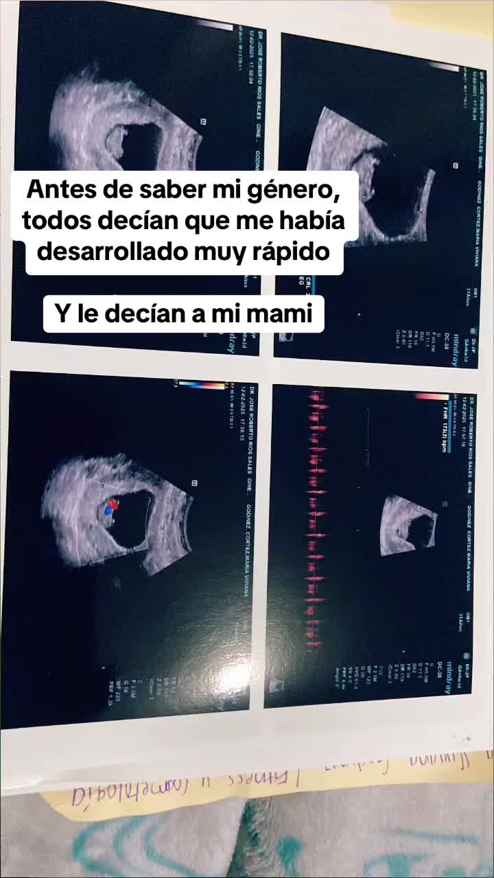 @Vivi Gnez