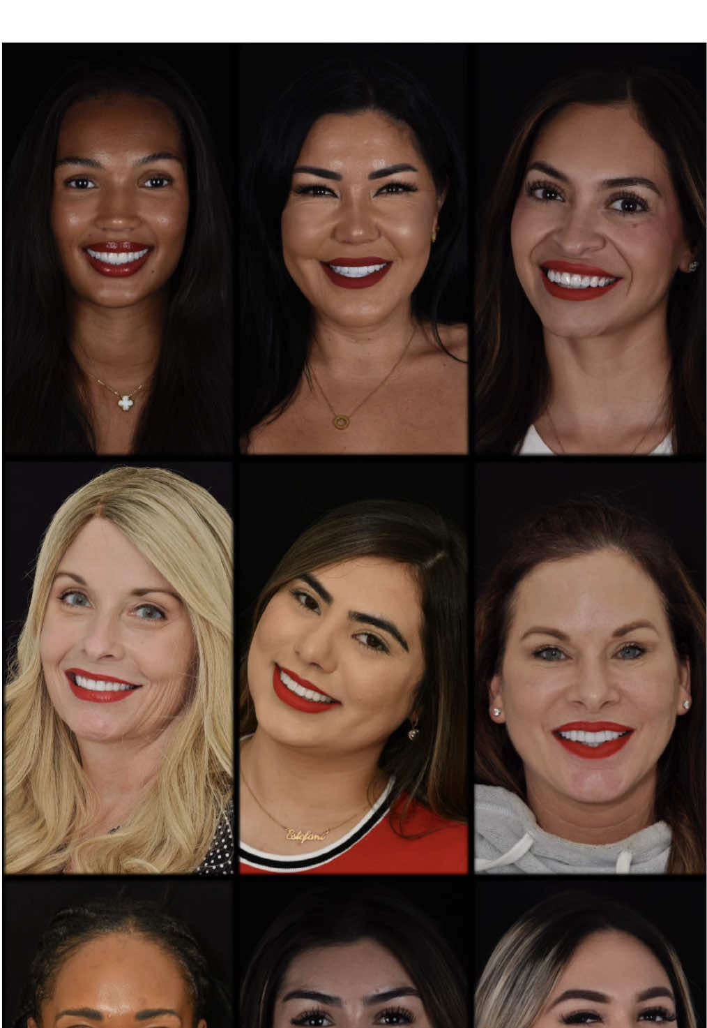 @Veneers