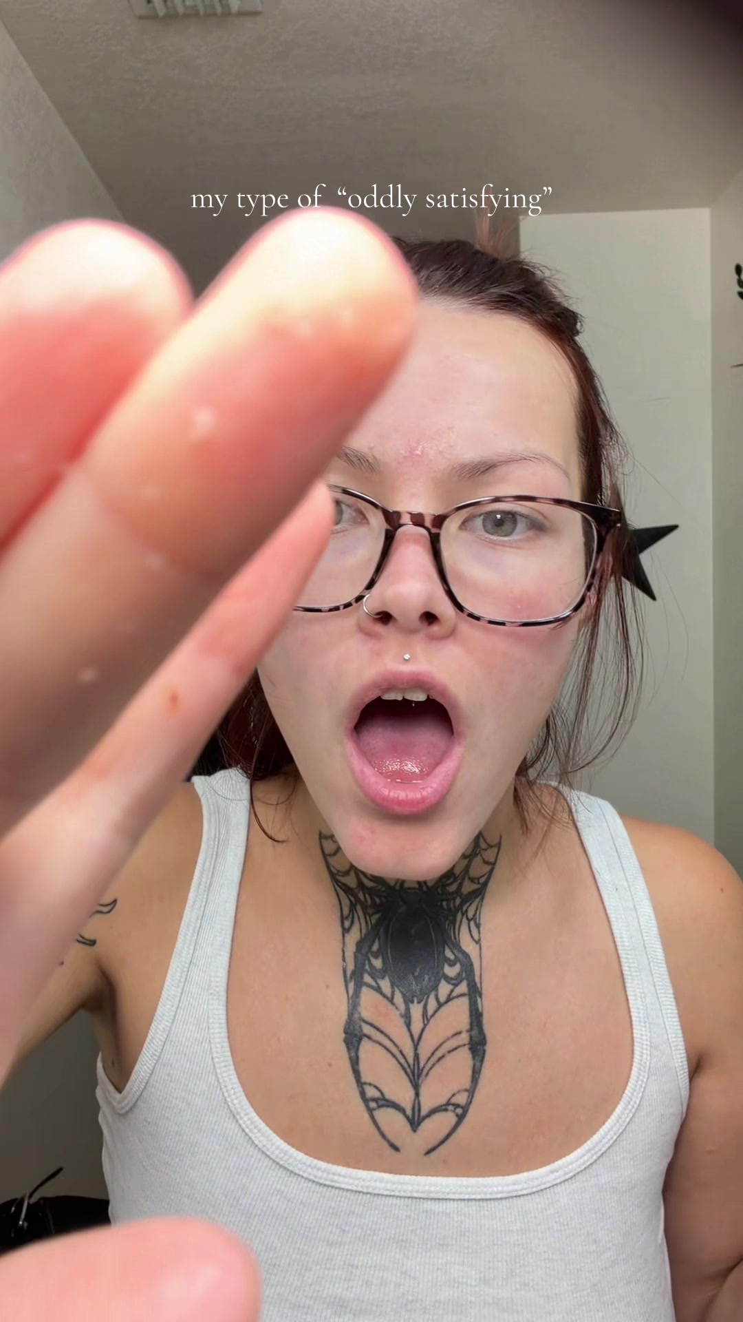 @Trashstarkace