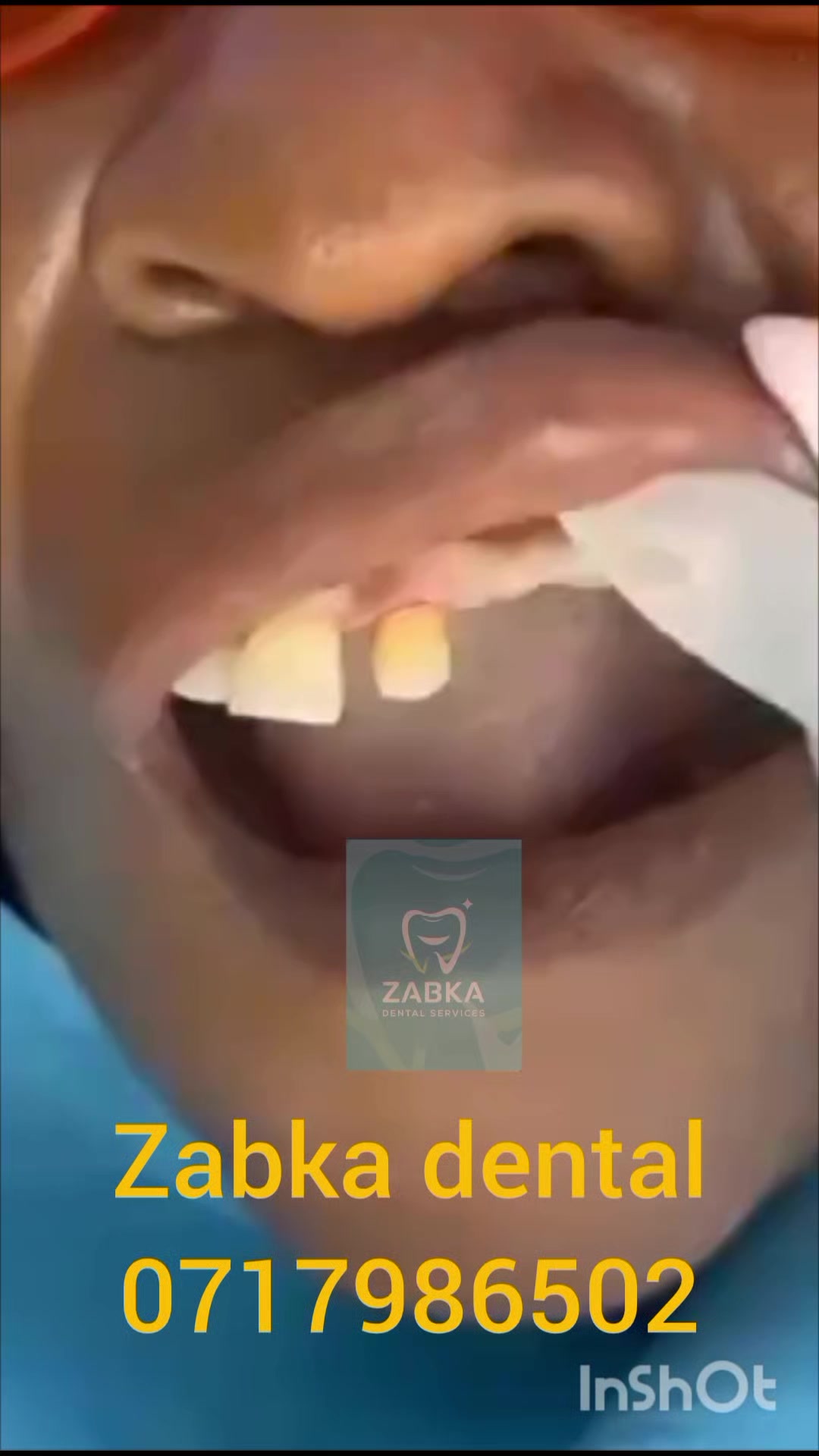 @Zabka Dental