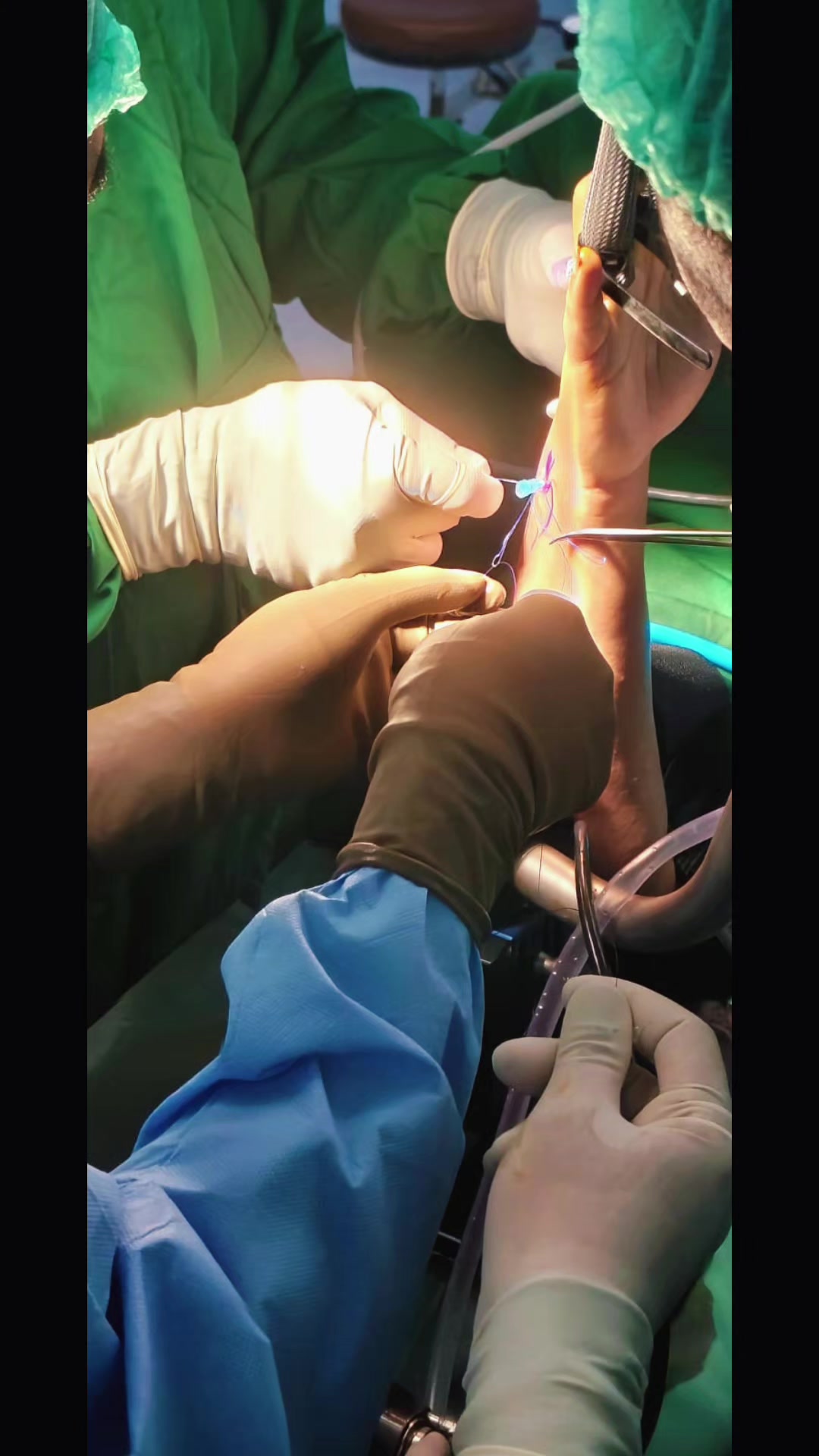 @AakashHandUpperlimbSurgeon