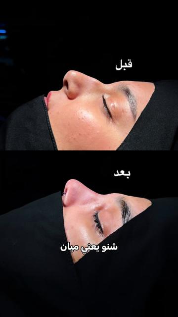 @dr.mhmd.alalawi