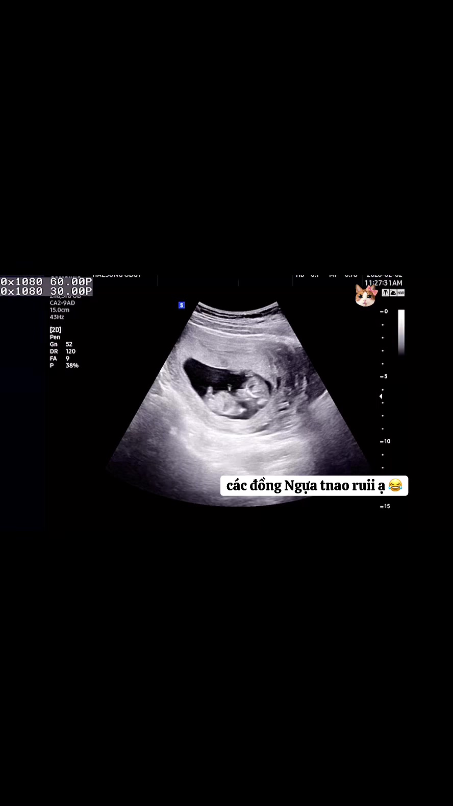 @Mẹ Đậuu iuu 🇻🇳🇰🇷