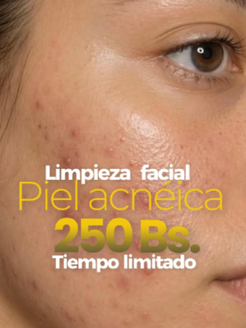 @RebellSpa