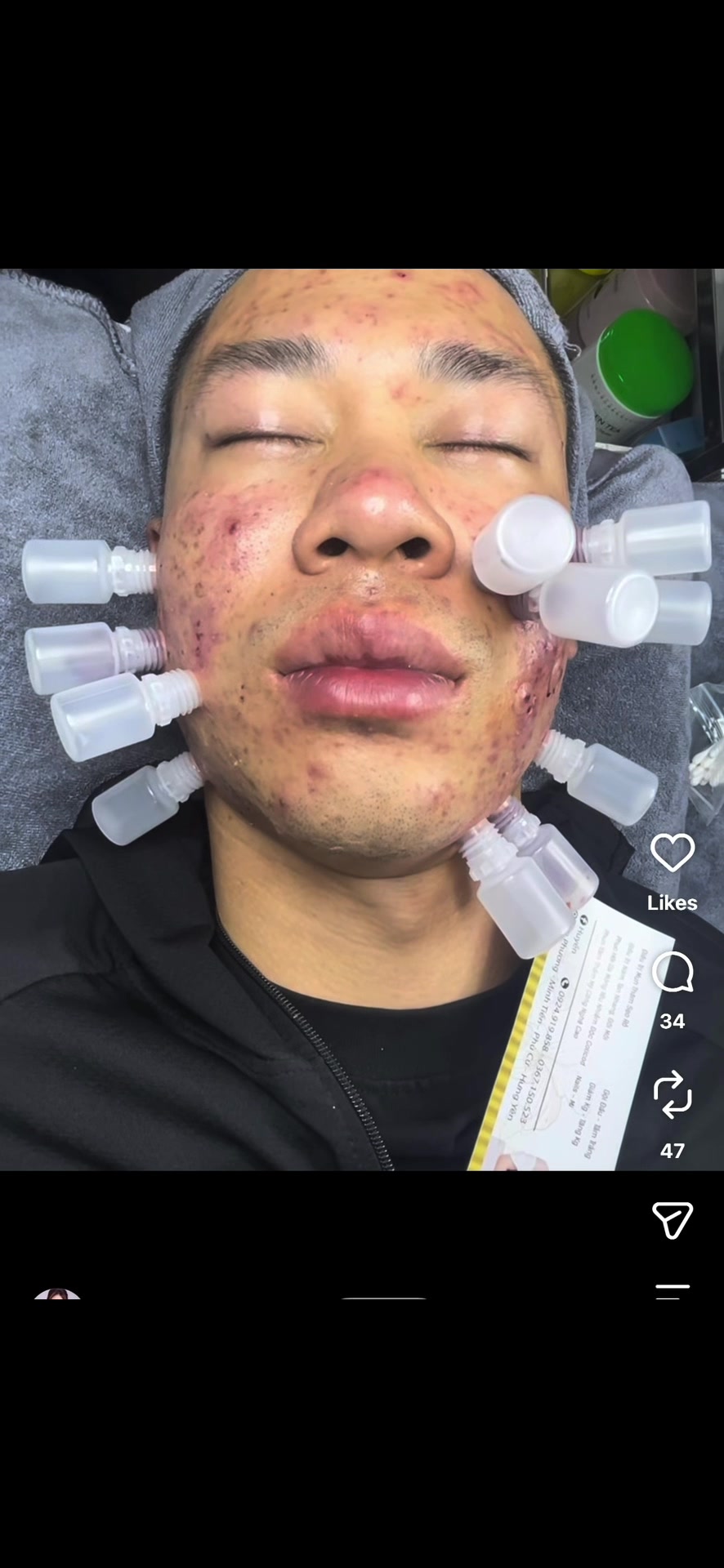 @Pure Skin OC
