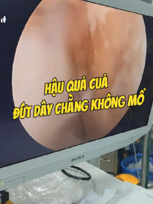 @Chuy&ecirc;n gia xương khớp