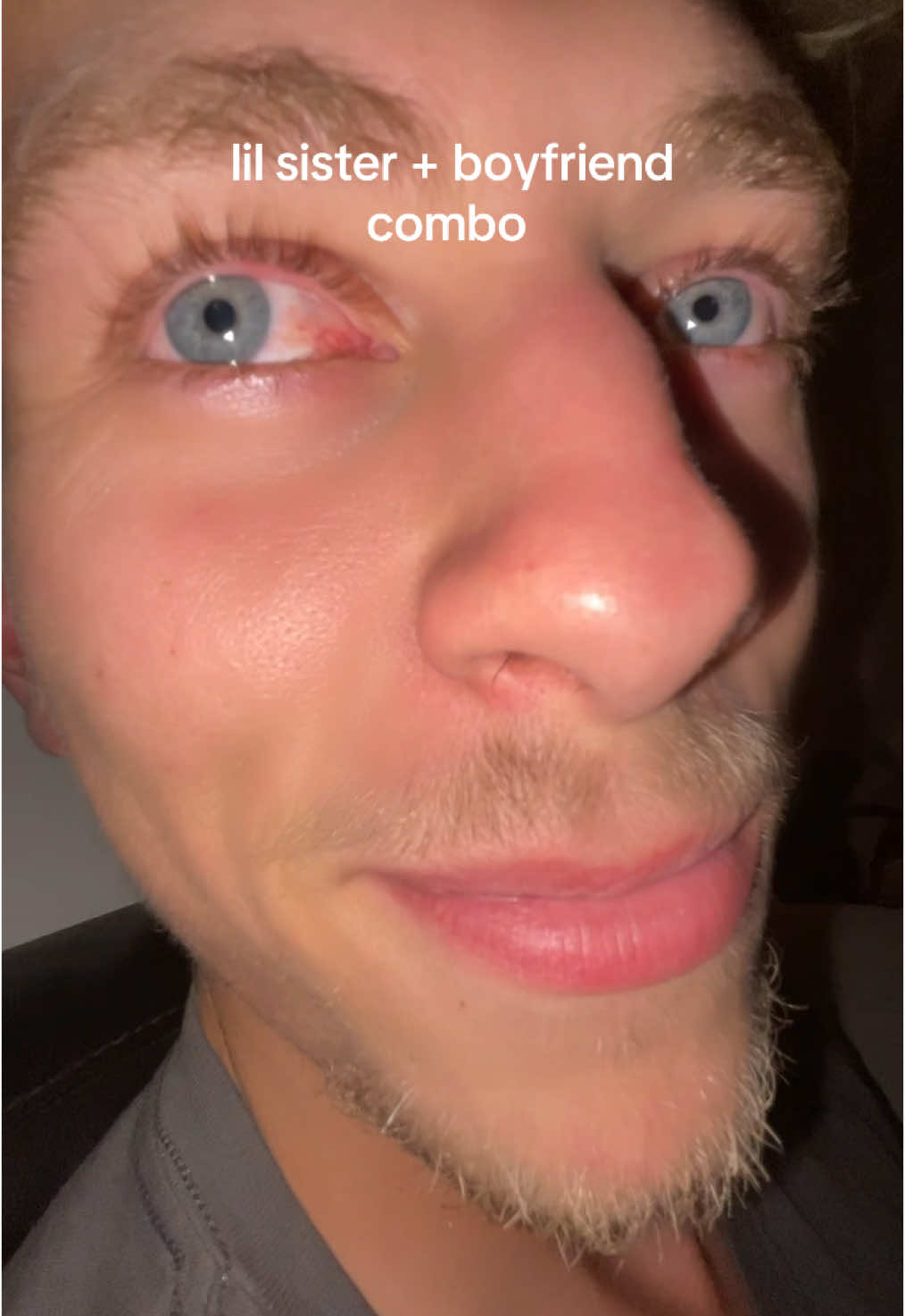 @🧀