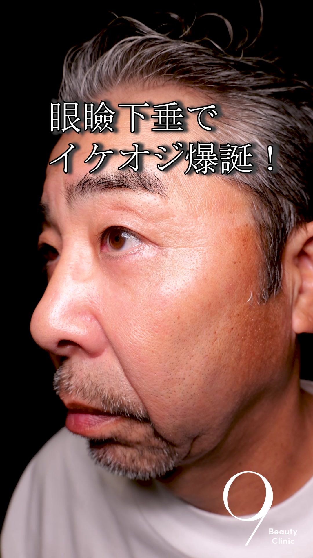 @りく先生　目元切開/クマ治療