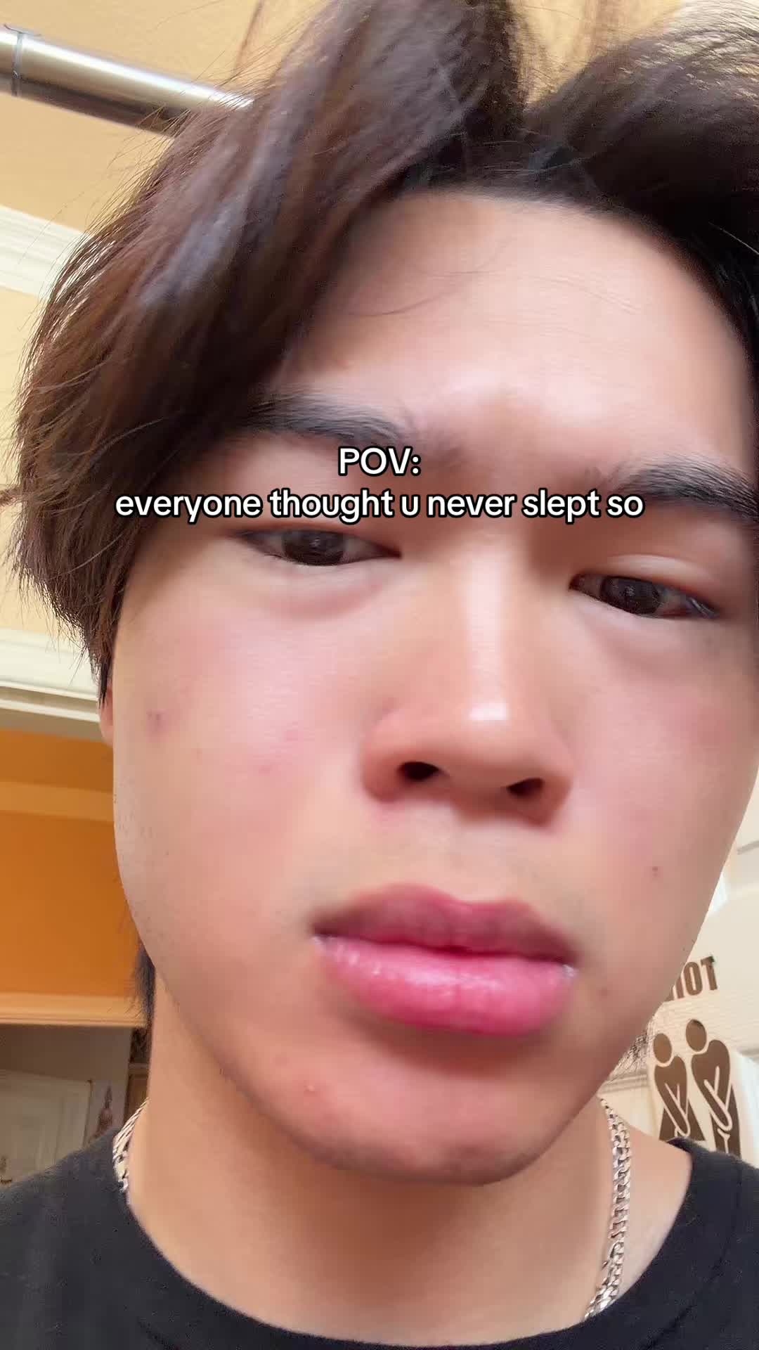 @detected