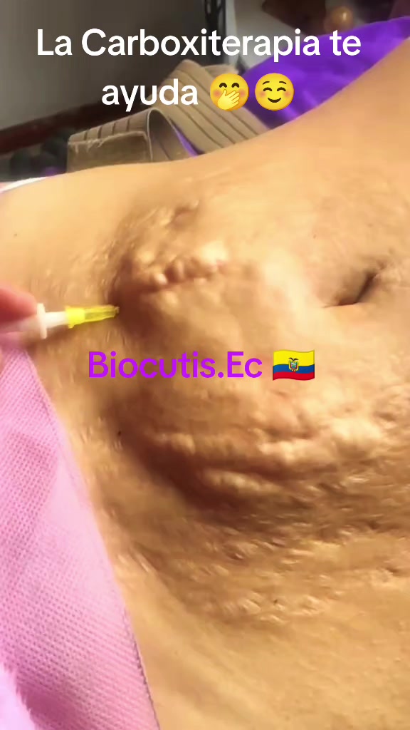 @BIOCUTIS ESTÉTICA ECUADOR