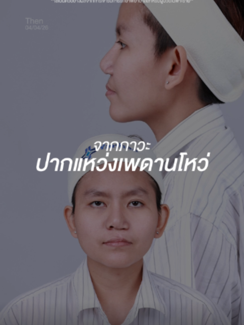 @โรงพยาบาลยันฮี