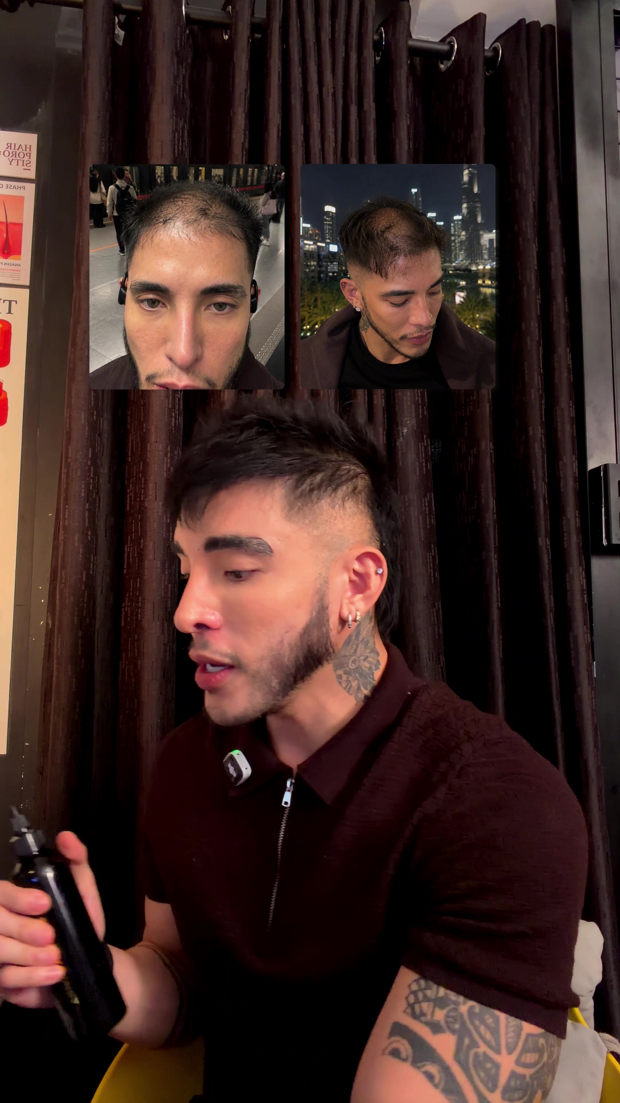 @Ramon Natcher | Hair Regrowth