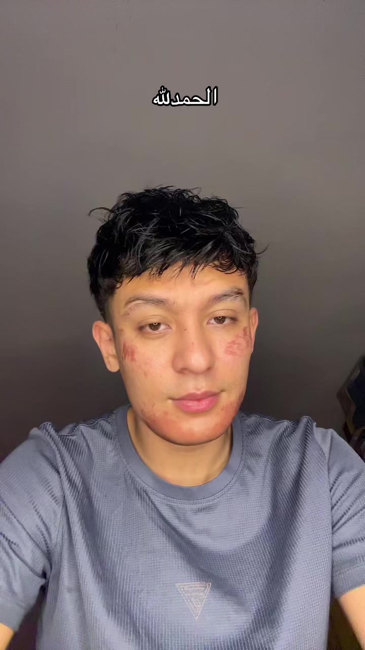 @سامر الفلبيني🇵🇭