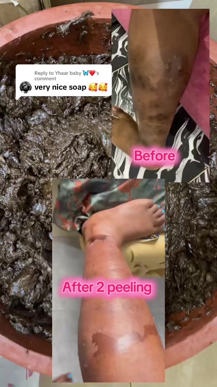 @@ Precious peeling soap