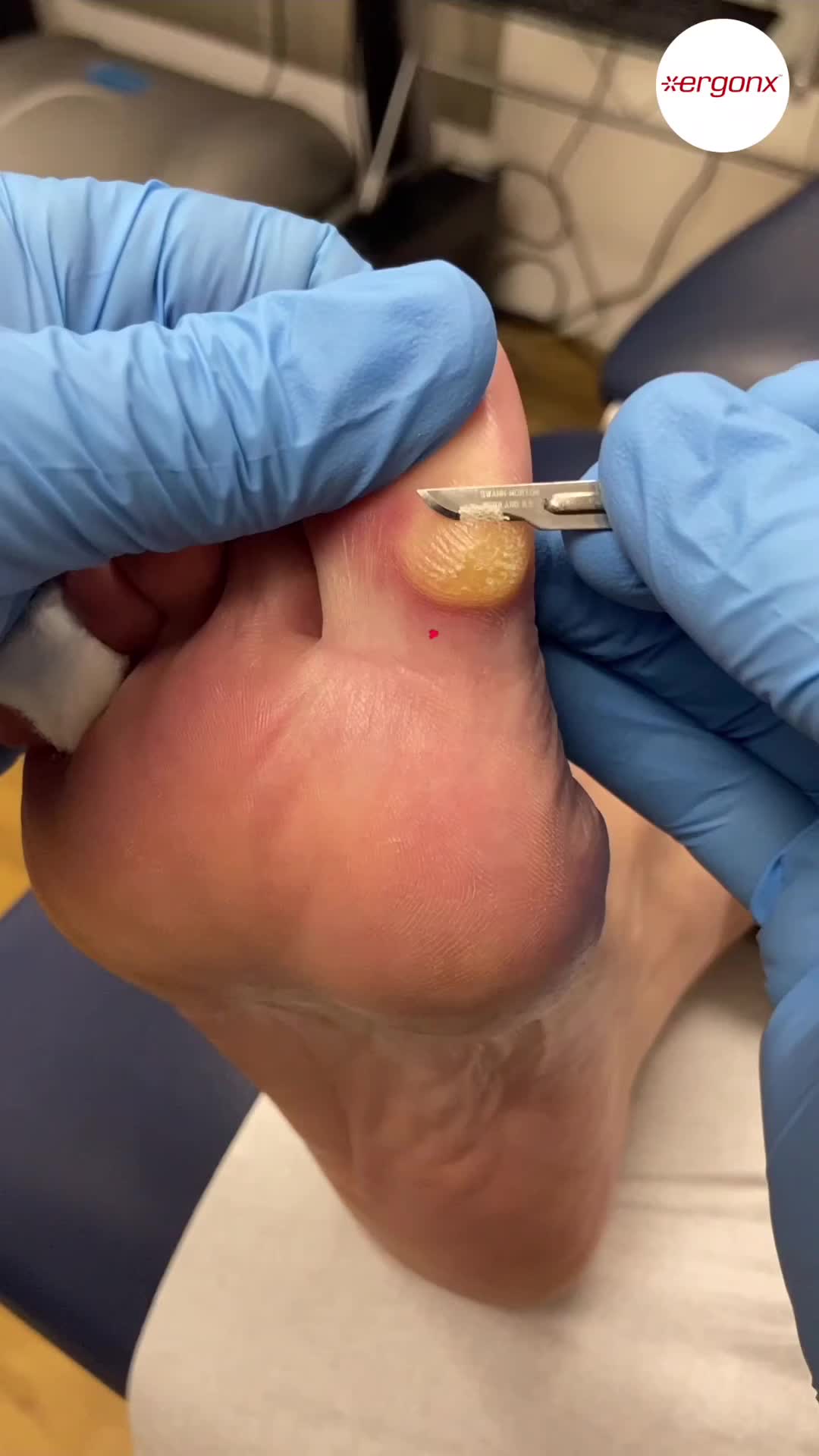 @ergonx