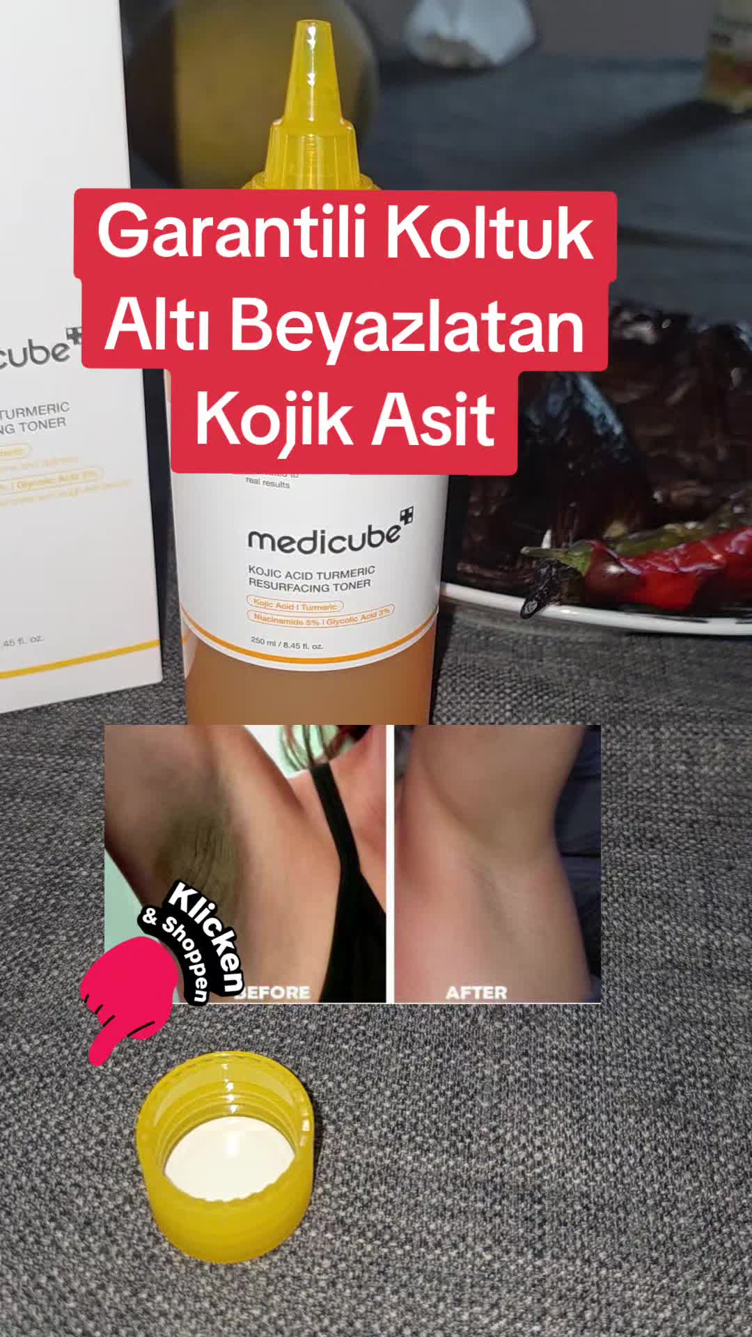 @Gurbetana27