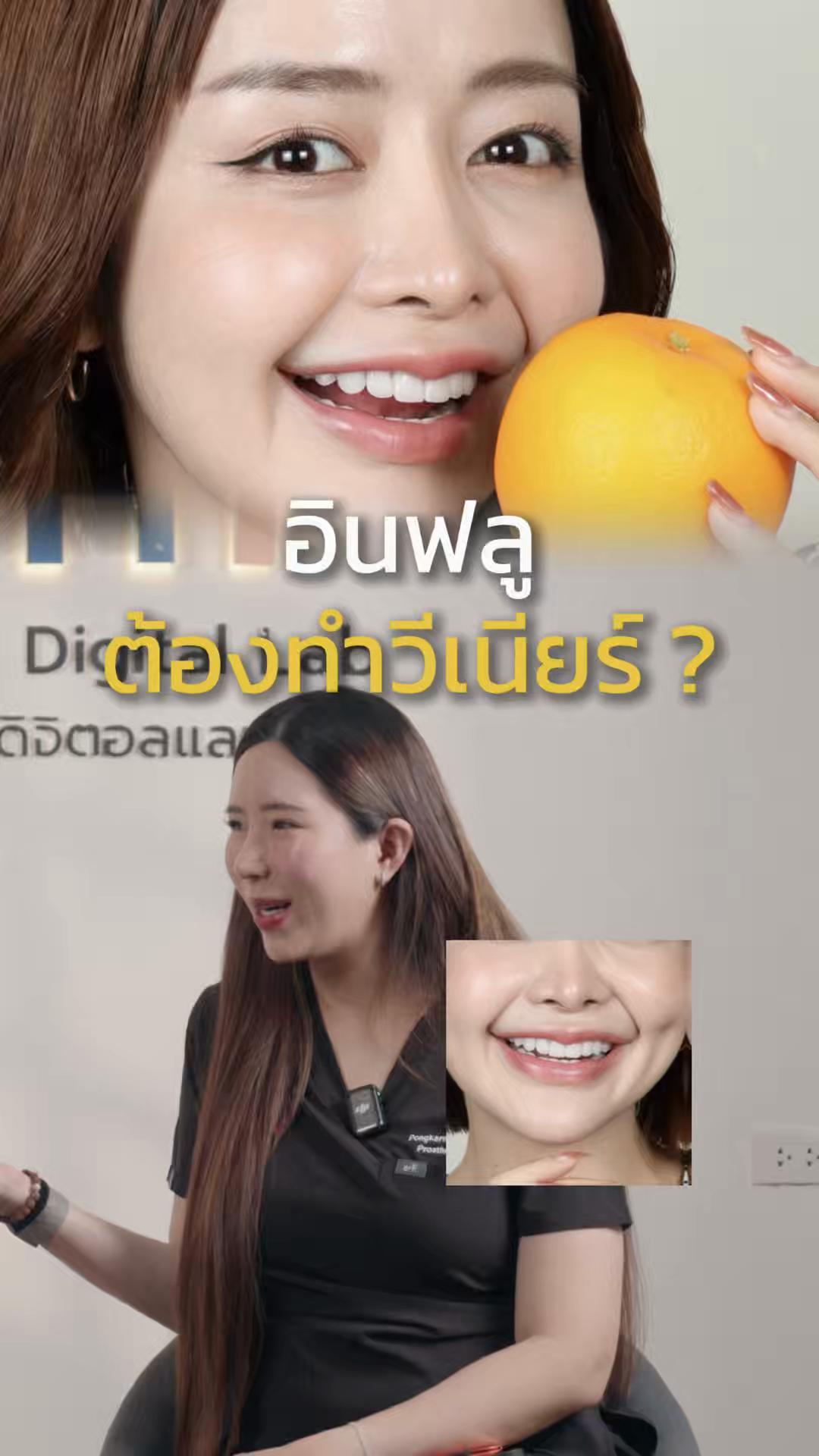 @หมอป่องสวยมาก veneer 🦷
