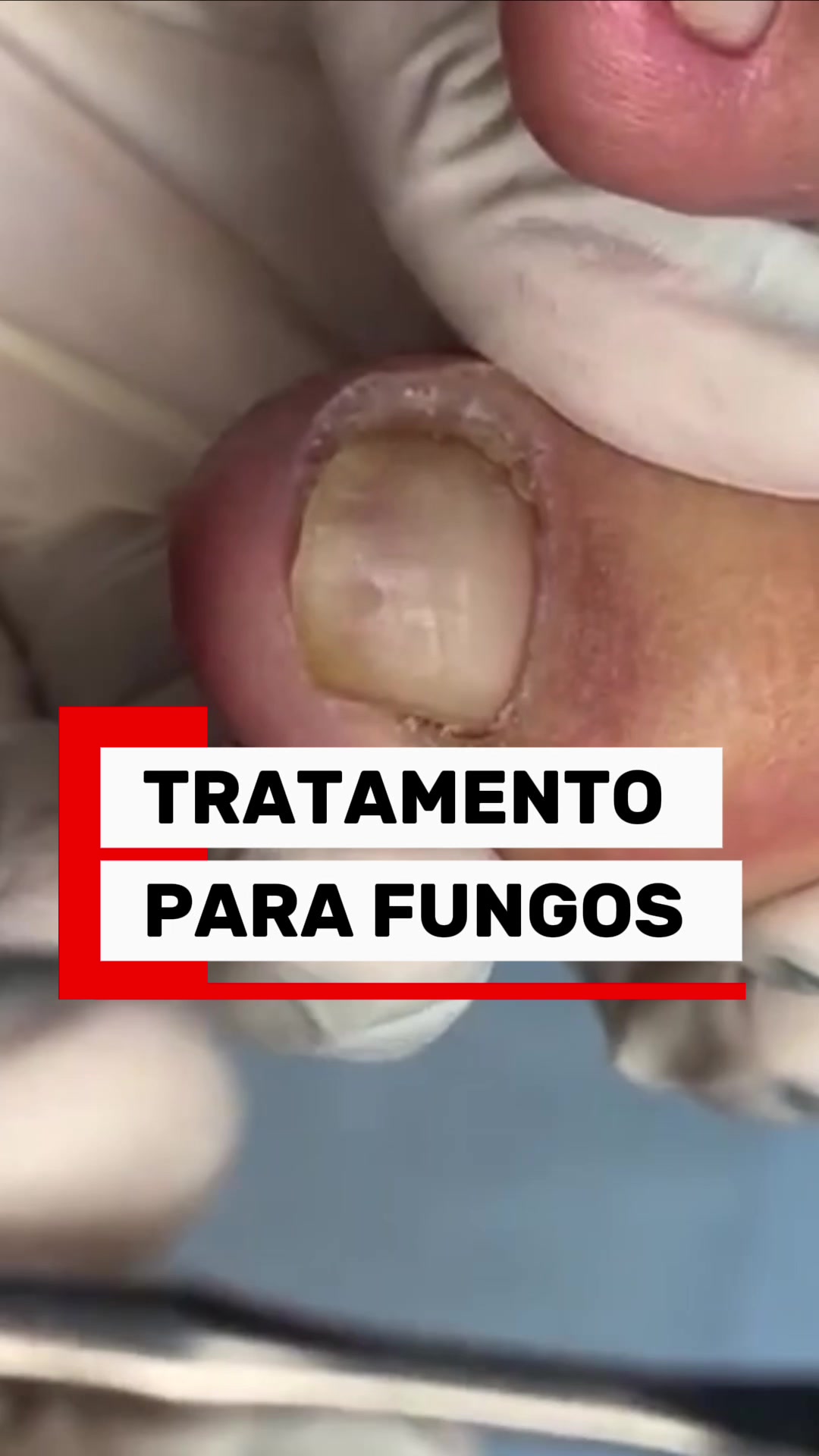 @Podocurebr