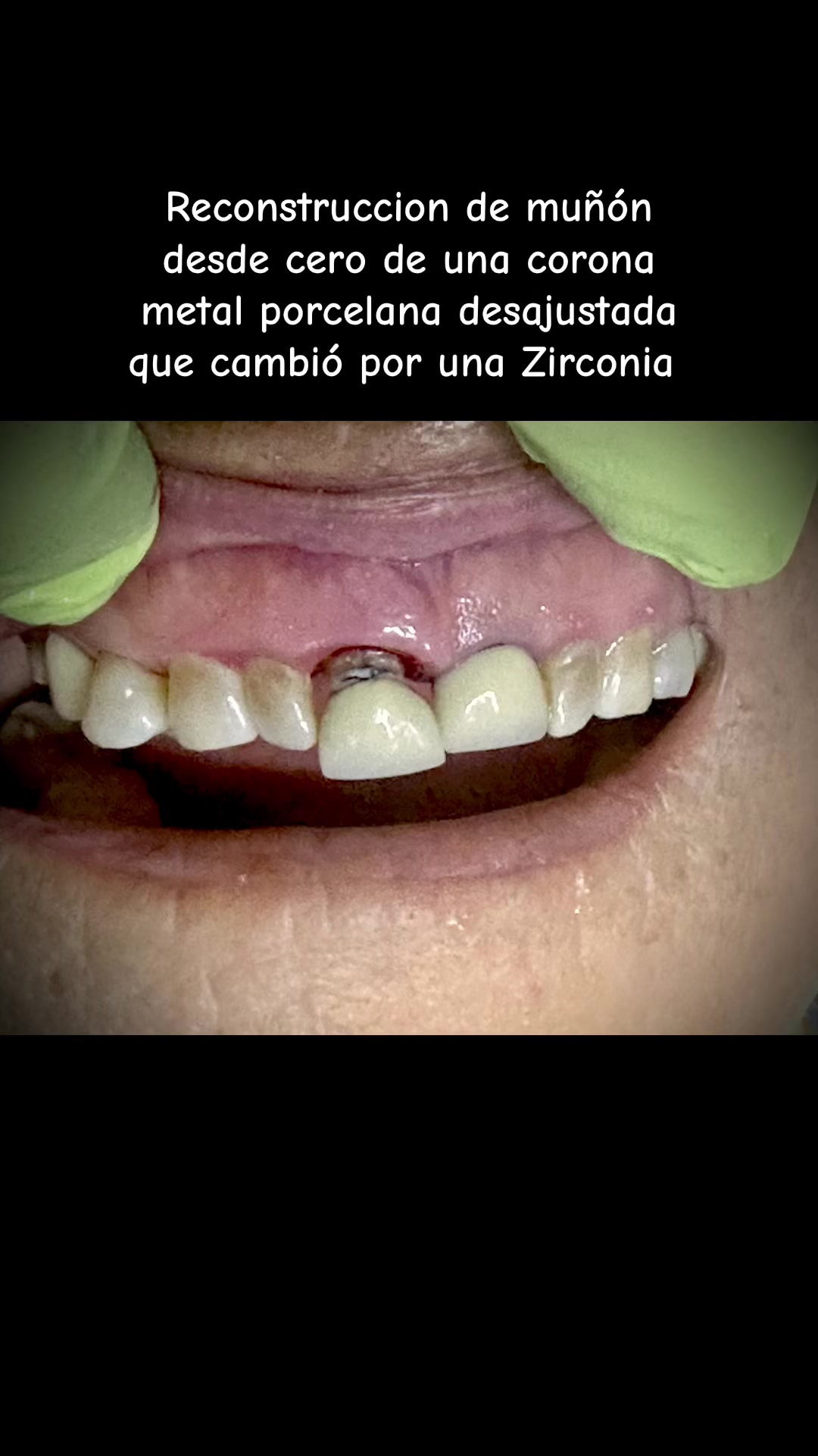 @La Doc TitaGuUb