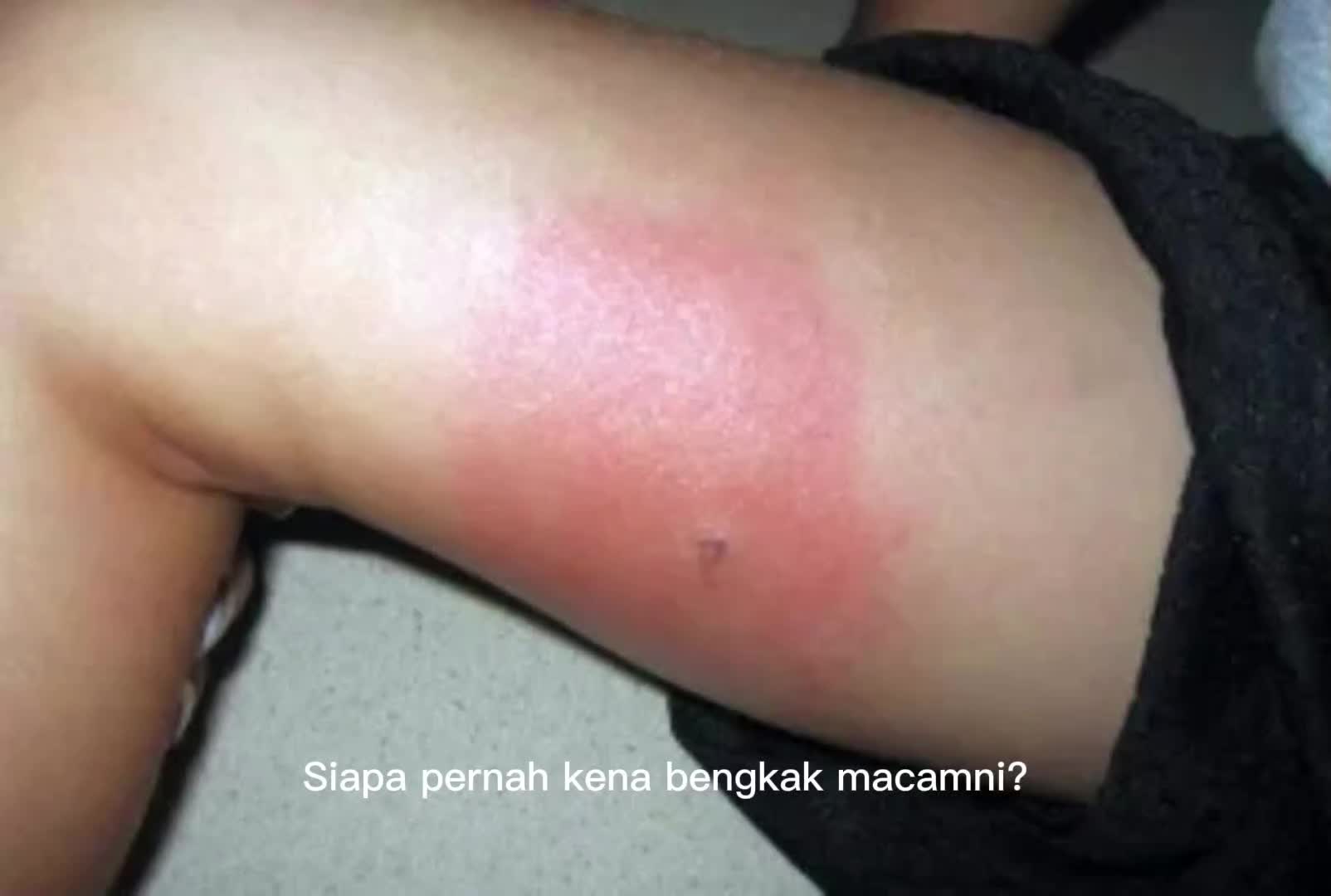 @MALAGHAZALI