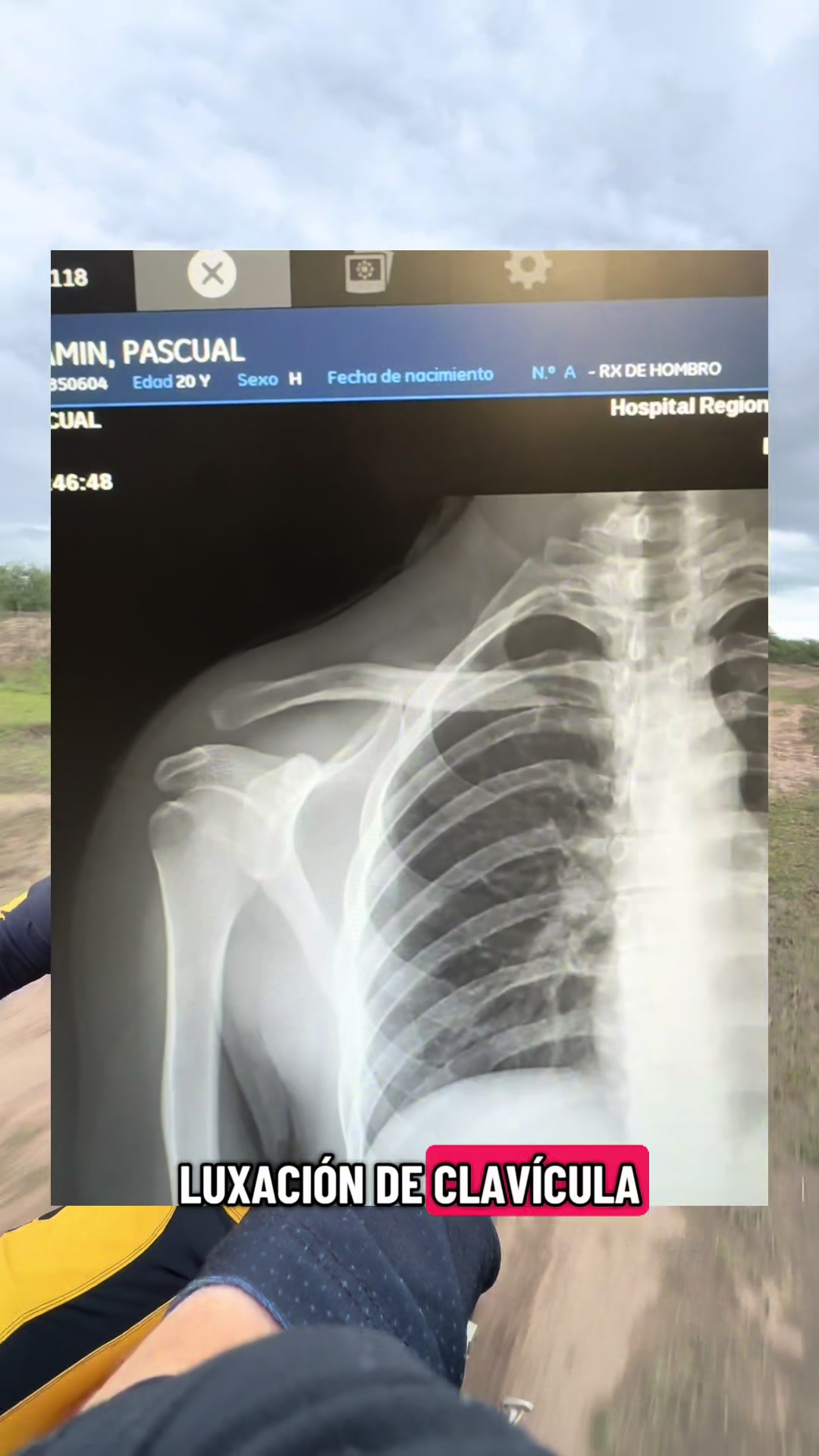 @Benjamin Pascual 30