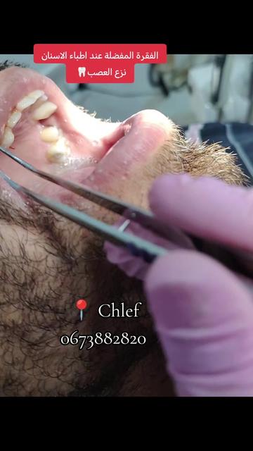 @Dr HASSOUN02 طبيبة الاسنان شلف