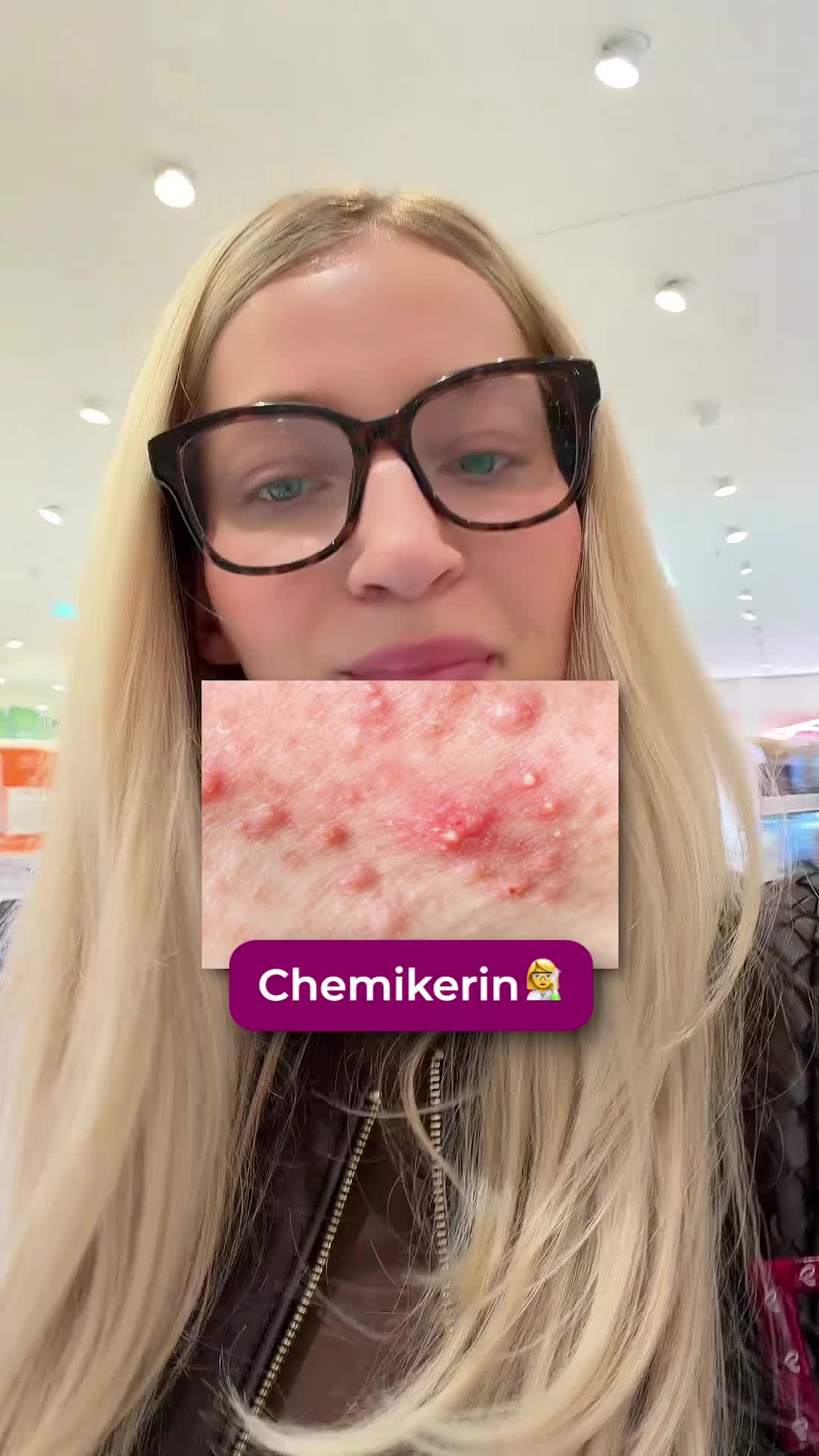 @skinbymerit