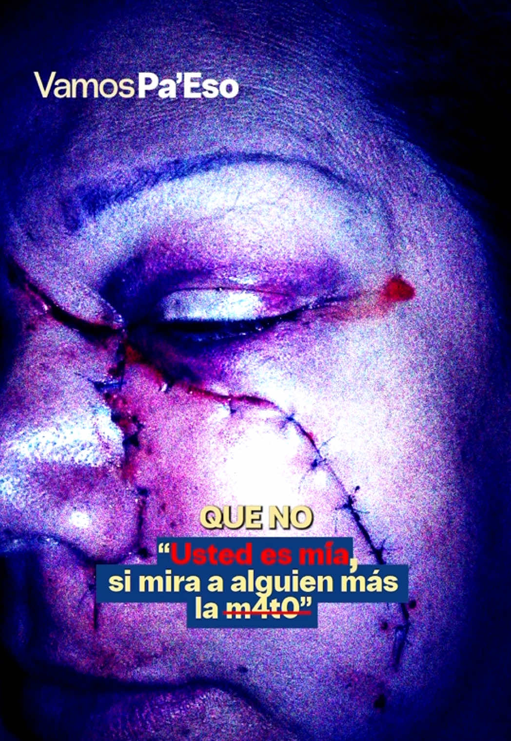 @Vamos pa eso