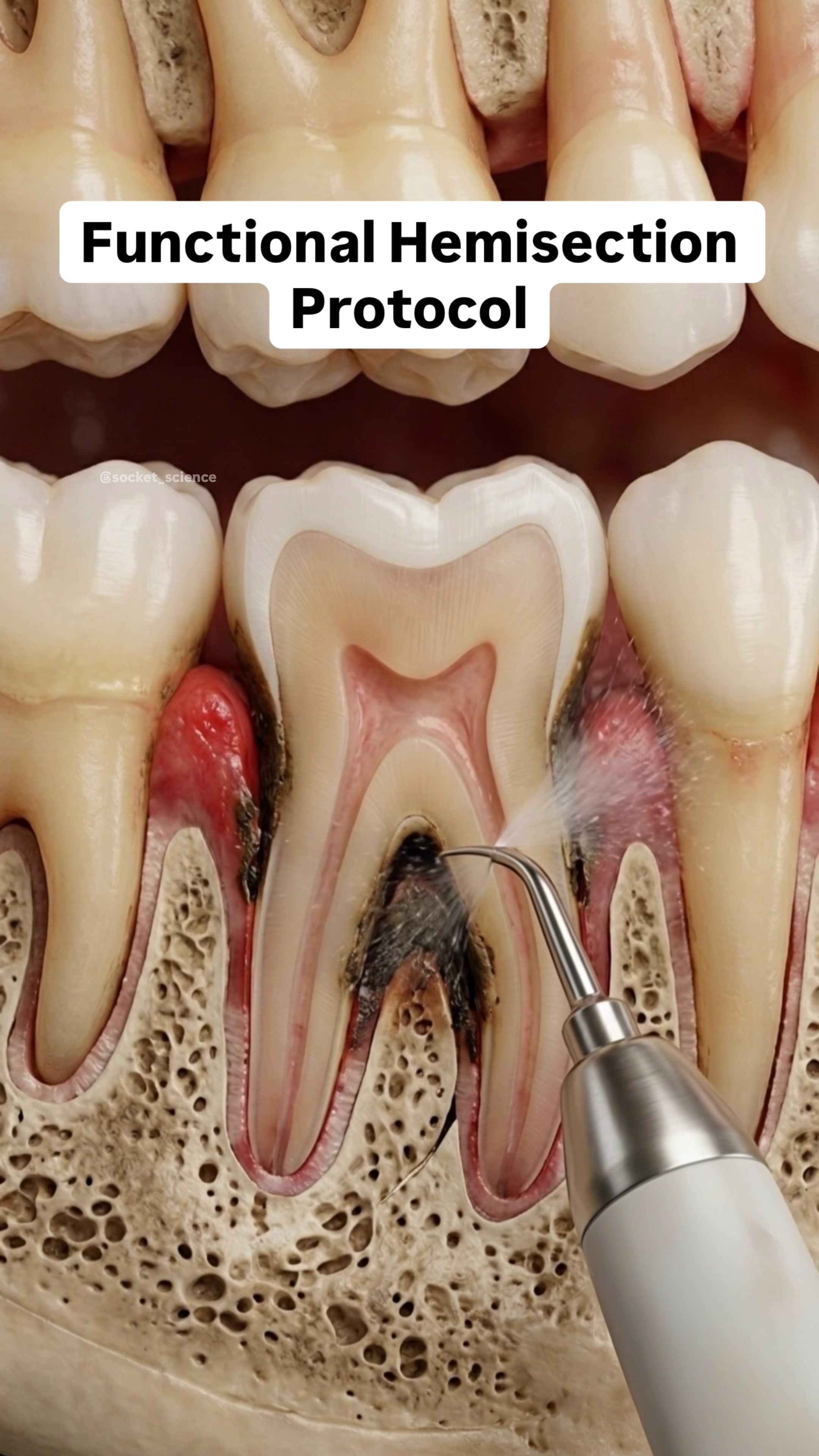 @Socket Science | Dental Visual