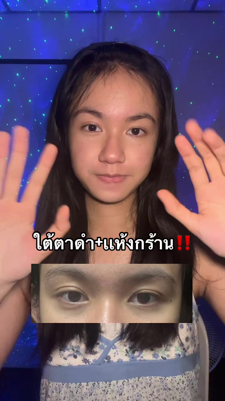 @อะป๊อป(Apop)