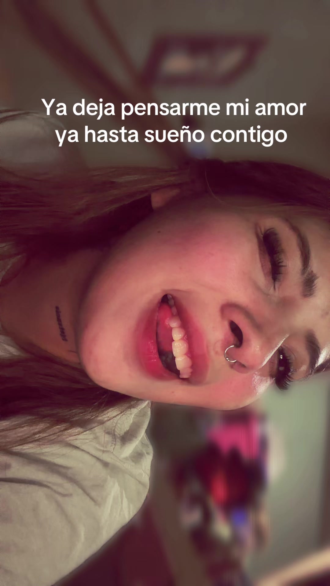 @Akarii MG