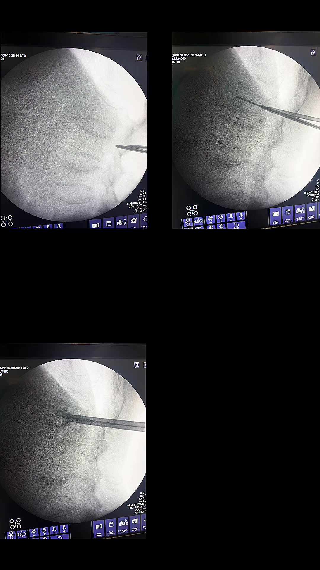 @Orthopedic_Surgeon_Arbind