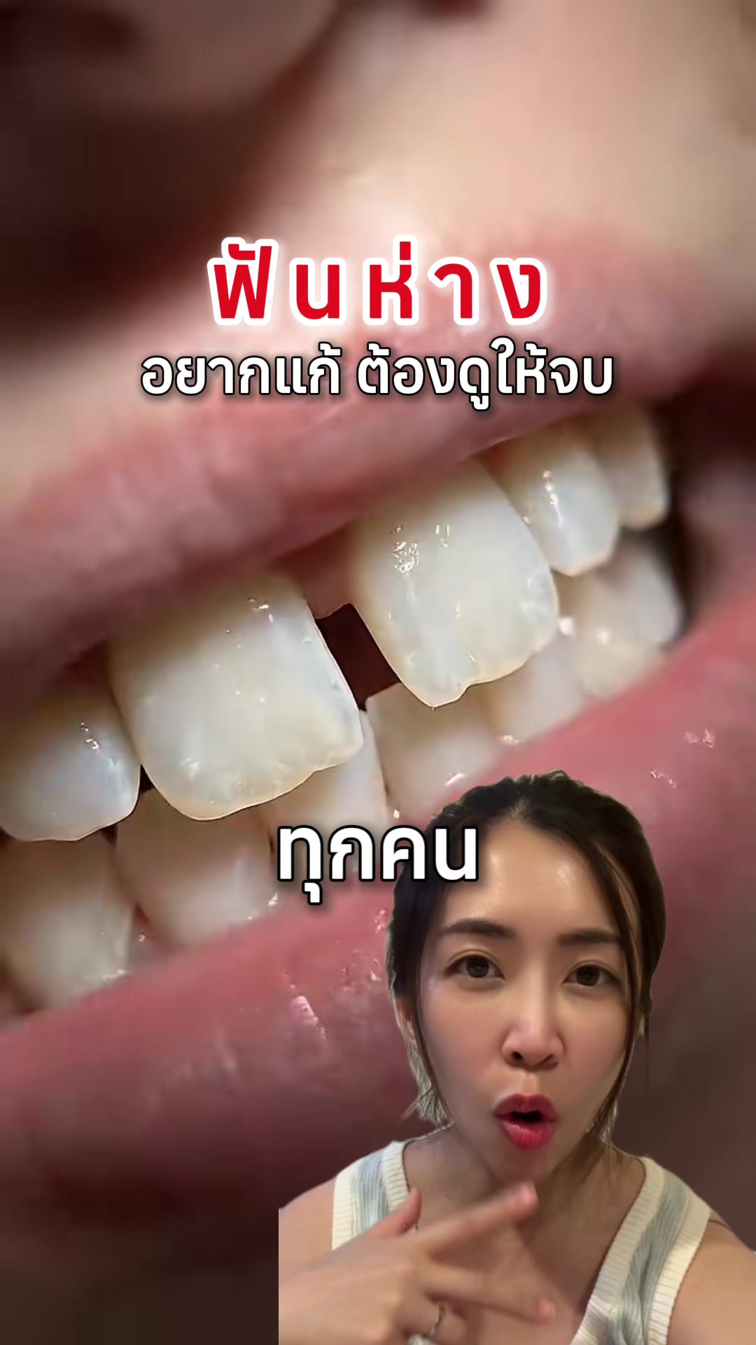 @ณัฐคุณ (Nuttakul Dent) 🦷
