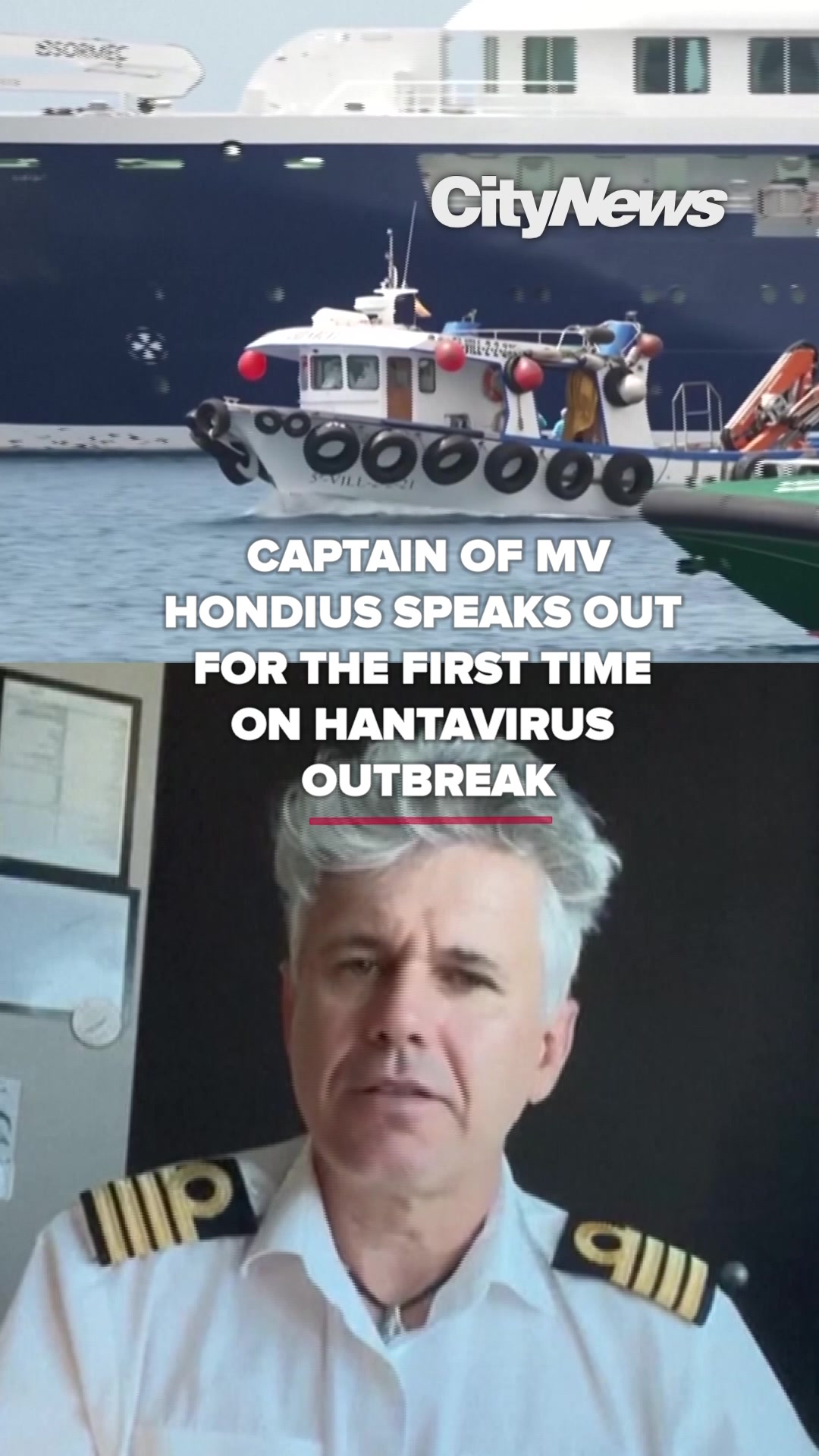 @CityNews