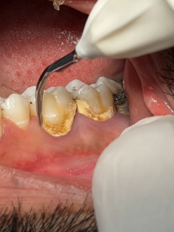 @DentalTreatment