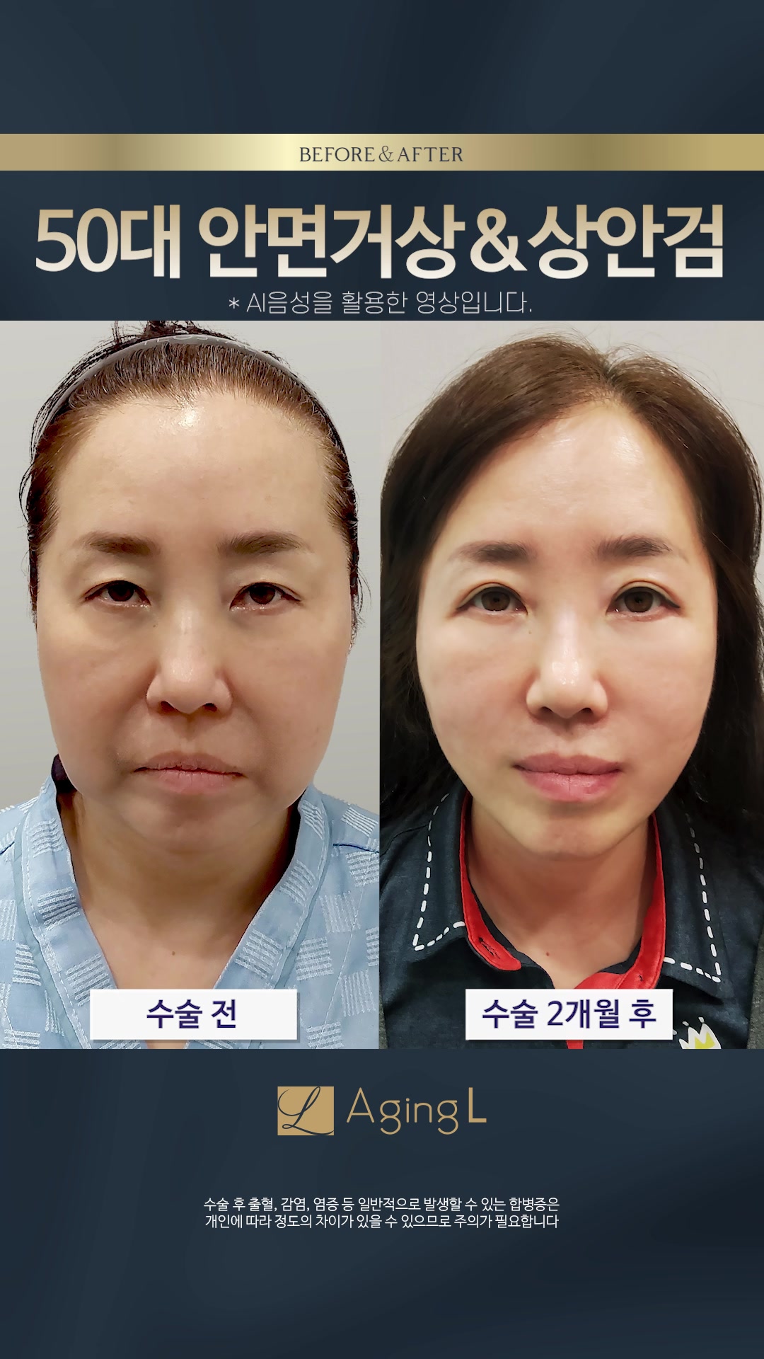 @agingl_official