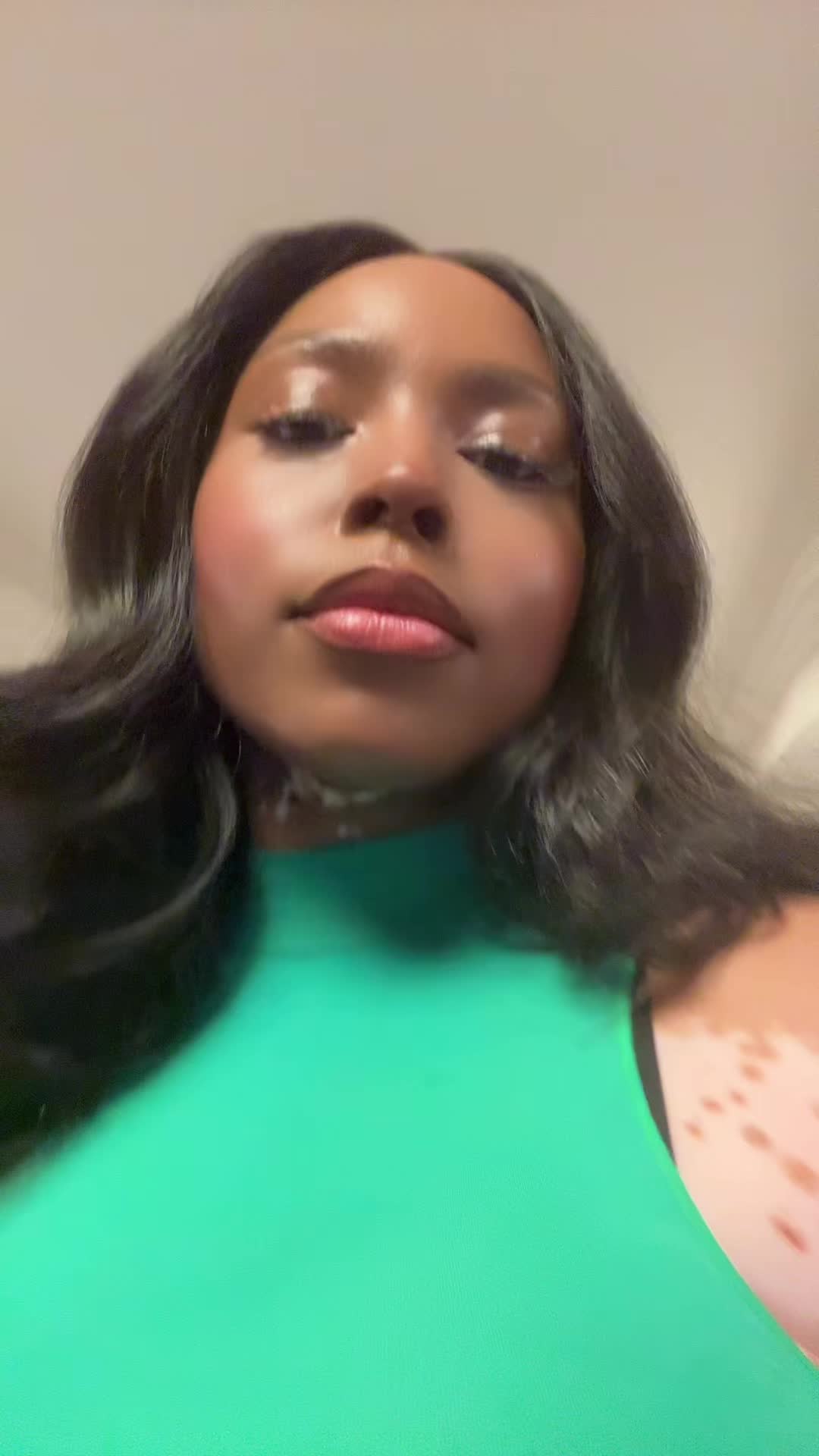 @VitiligoFairy