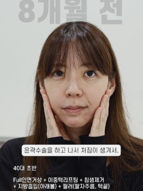 @다시피움성형외과 DASIPIUM タシピウム