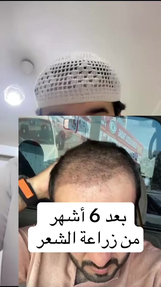 @Dr. Ahmed Alkhateeb